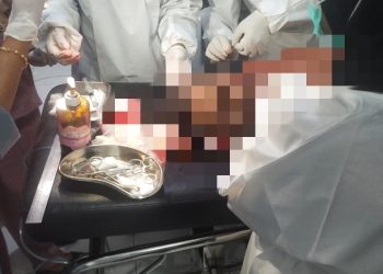 Lagi! Warga Sipil Jadi Korban penganiayaan dengan menggunakan senjata tajam di Yahukimo, Diduga Dilakukan KKB